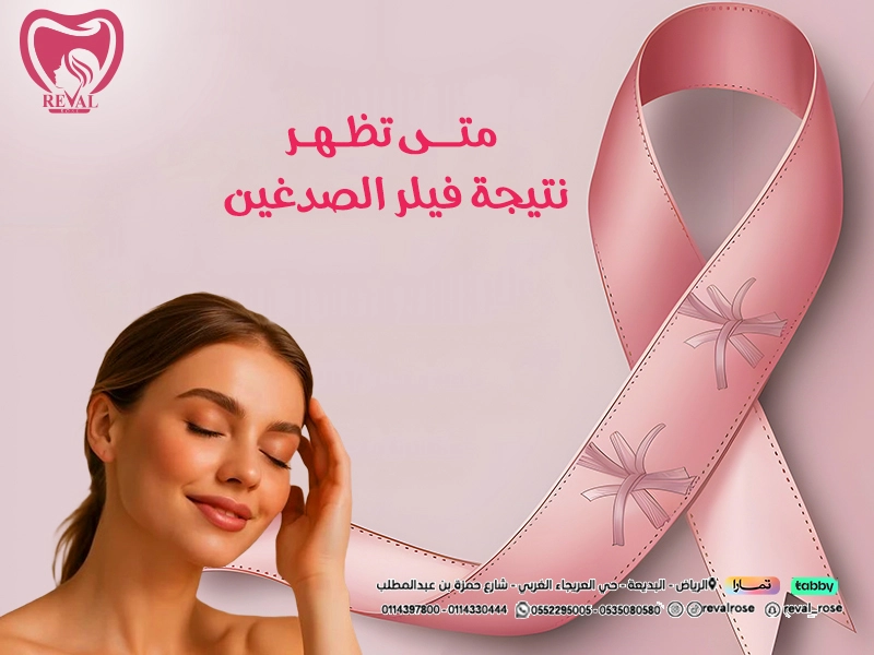 اسرار حقن فيلر الأصداغ: متى تظهر نتيجة فيلر الصدغين⁉️