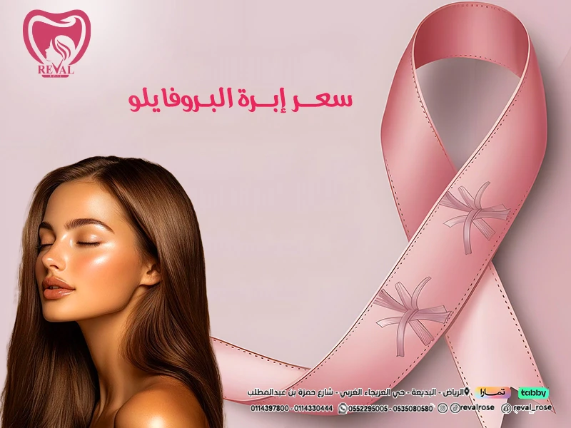 تجربتي مع إبرة البروفايلو: نصائح حقن بروفايلو الوجه profhilo