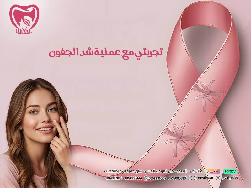 تجربتي مع عملية شد الجفون: اسرار شد الجفون بالليزر👌