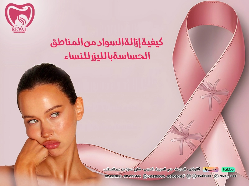 إزالة السواد من المناطق الحساسة بالليزر للنساء بالرياض: تعليمات قبل وبعد لنتائج تدوم