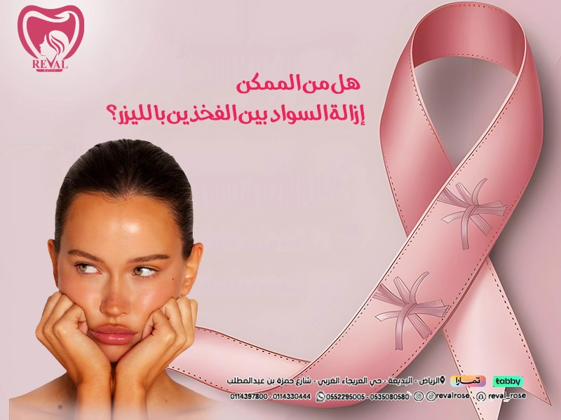 هل من الممكن إزالة السواد بين الفخذين بالليزر؟ اسرار جلسات التفتيح بالرياض تعرف عليها أولًا