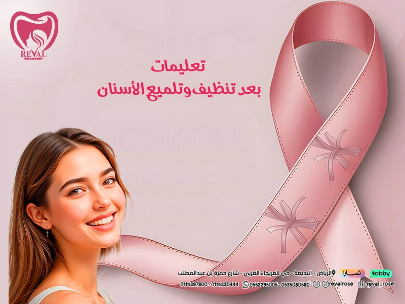 تعليمات بعد تنظيف وتلميع الاسنان للحفاظ على ابتسامة صحية ولامعة بالرياض