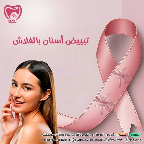 تجربتي مع تبييض الأسنان بالفلاش
