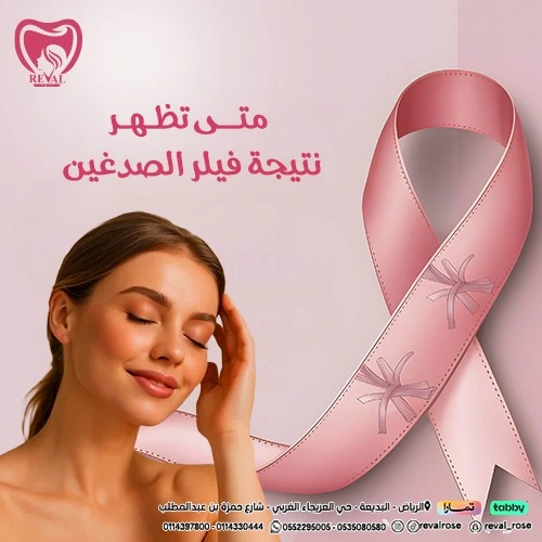 تجربتي مع فيلر الصدغين