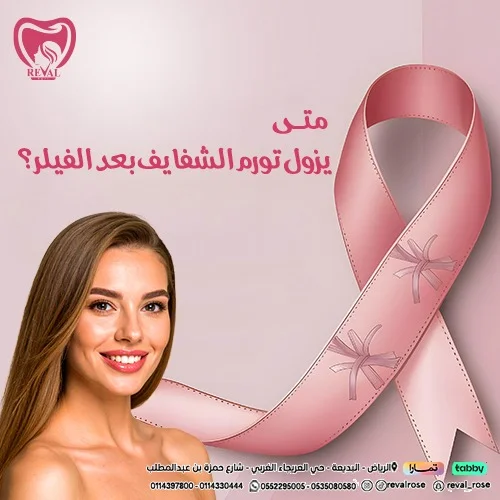 نصائح بعد فيلر الشفايف