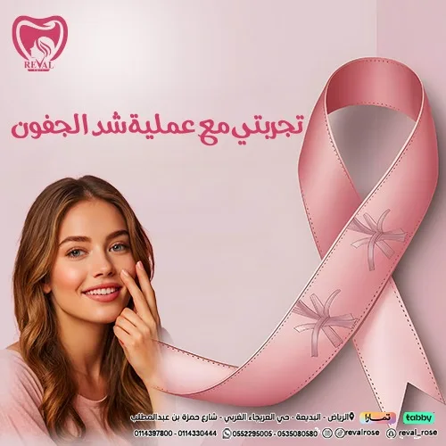 متى تظهر نتائج شد الجفون بالليزر؟_كم يستمر مفعول شد الجفون بالليزر؟