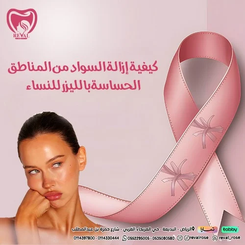 تجربتي مع إزالة السواد من المناطق الحساسة بالليزر للنساء
