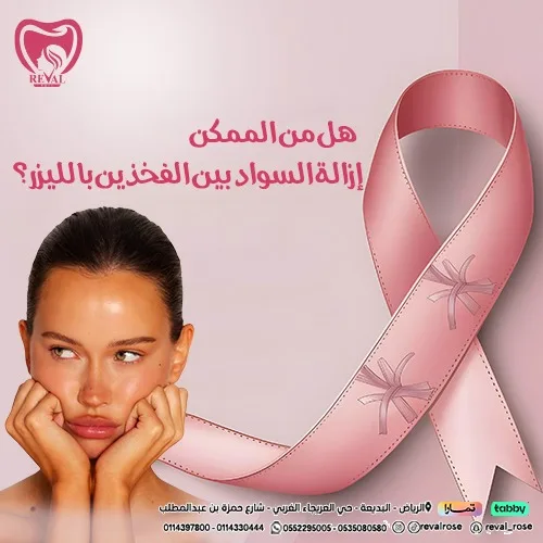 تجربتي مع إزالة السواد بين الفخذين بالليزر