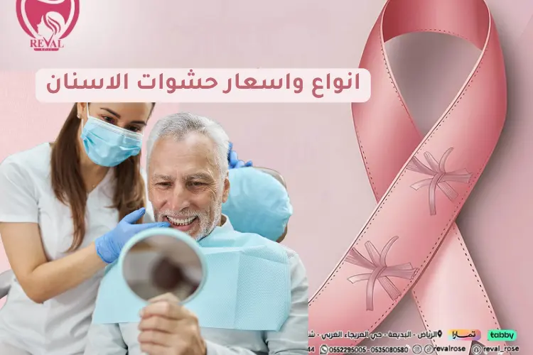 انواع واسعار حشوات الاسنان