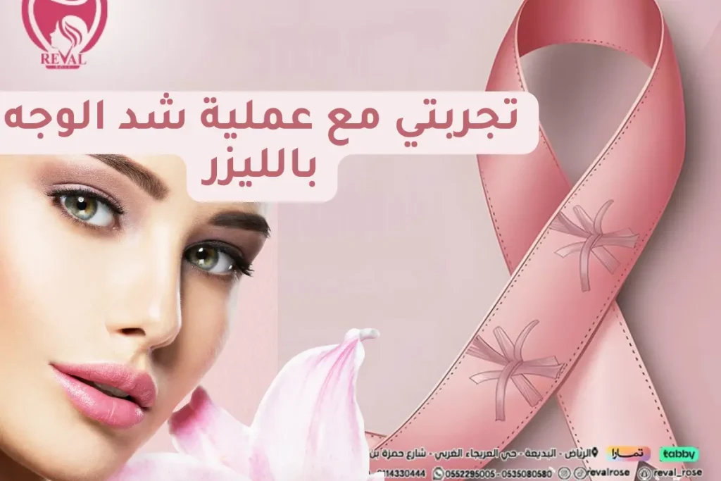 تجربتي مع عملية شد الوجه بالليزر