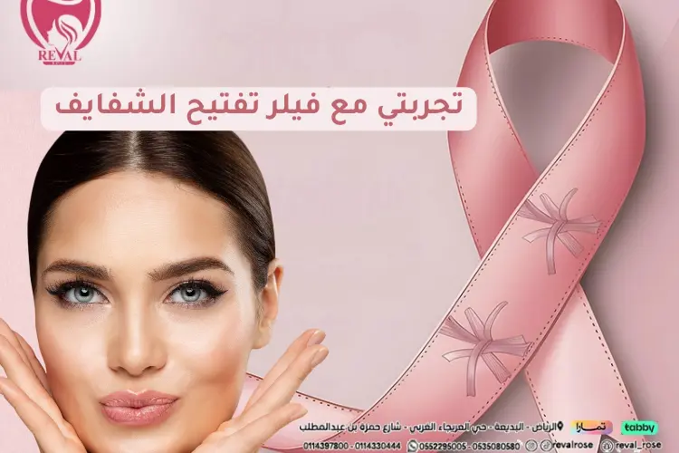تجربتي مع فيلر تفتيح الشفايف
