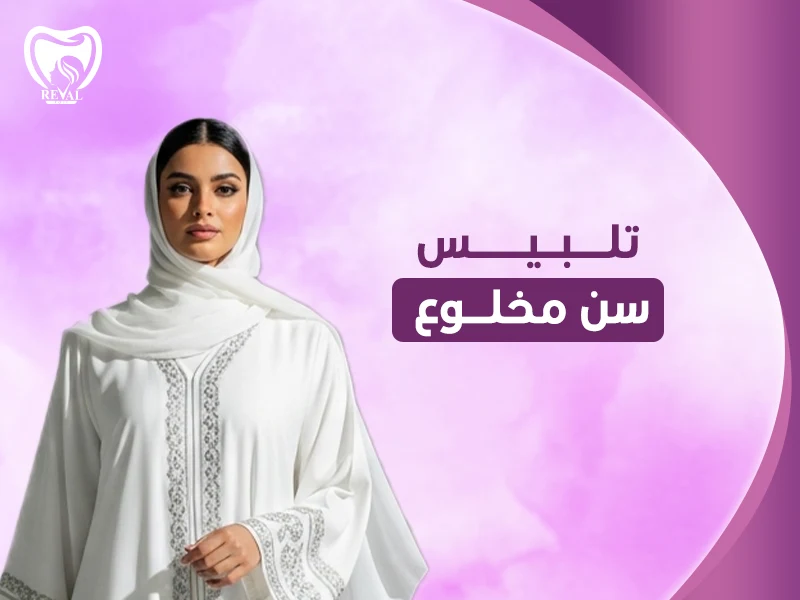 تلبيس سن مخلوع: هل يمكن تركيب ضرس في مكان الضرس المخلوع؟