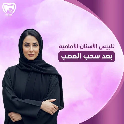 تجربتي مع تلبيس الأسنان الأمامية بعد سحب العصب