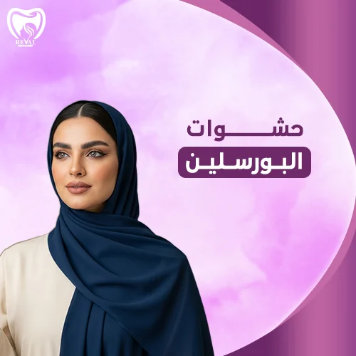 كم تدوم حشوات البورسلين؟