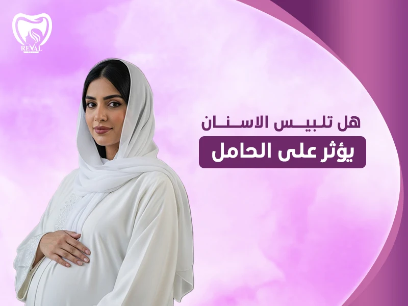 هل تلبيس الأسنان يؤثر على الحامل؟ مخاطر علاج الأسنان أثناء الحمل