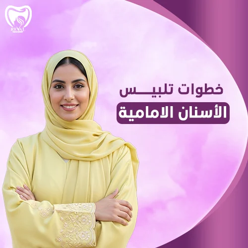 تجربتي مع تلبيس الأسنان