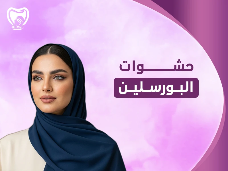 حشوات البورسلين بالرياض: ما هي مدة بقاء حشوة البورسلين؟