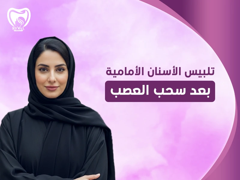 تلبيس الأسنان الأمامية بعد سحب العصب | هل يمكن خلع التلبيسة؟