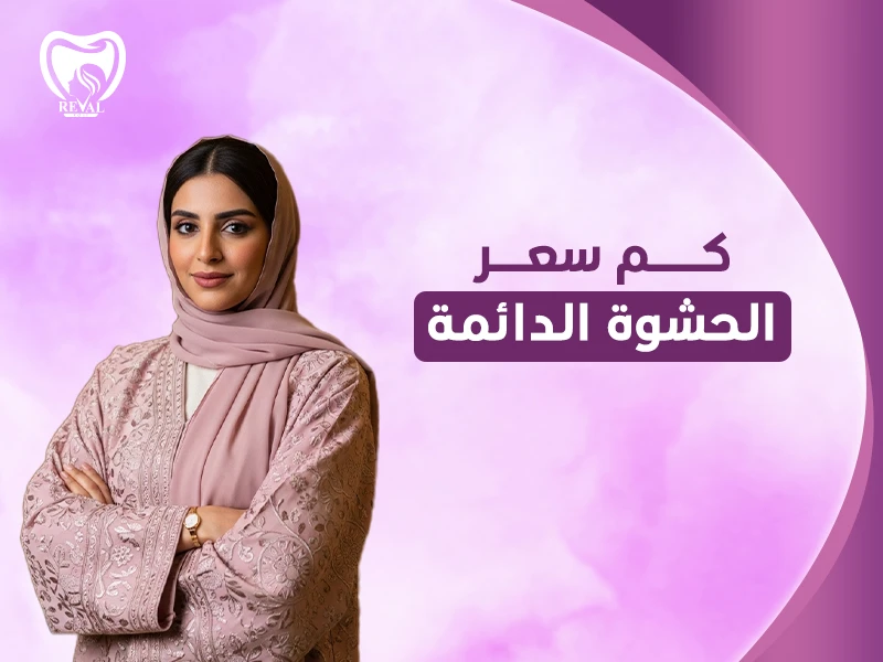كم سعر الحشوة الدائمة؟ وما هي أنواع الحشوات الدائمة في الرياض؟