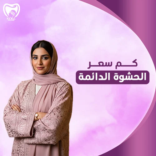 مدة بقاء الحشوة الدائمة