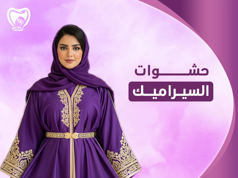 حشوات السيراميك– كم تدوم حشوة السيراميك؟ وسعر حشوة السيراميك