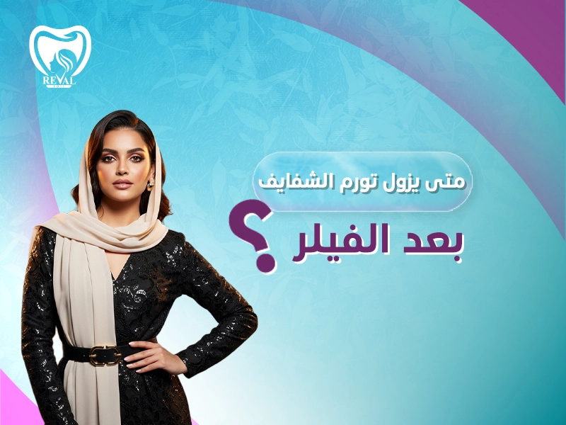 متى يزول تورم الشفايف بعد الفيلر؟ كيف أخفف الورم بعد فيلر الشفايف؟