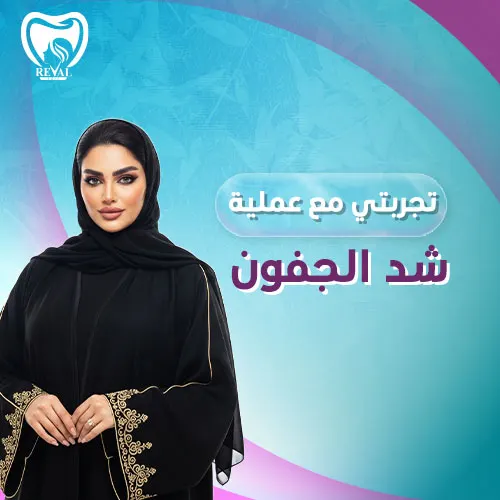 تجربتي مع عملية شد الجفون بالليزر