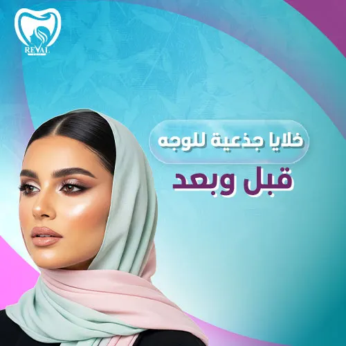 متى تظهر نتائج الخلايا الجذعية للوجه؟