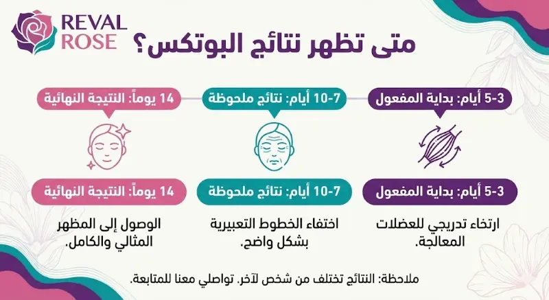 كم مدة بقاء البوتكس في الوجه؟