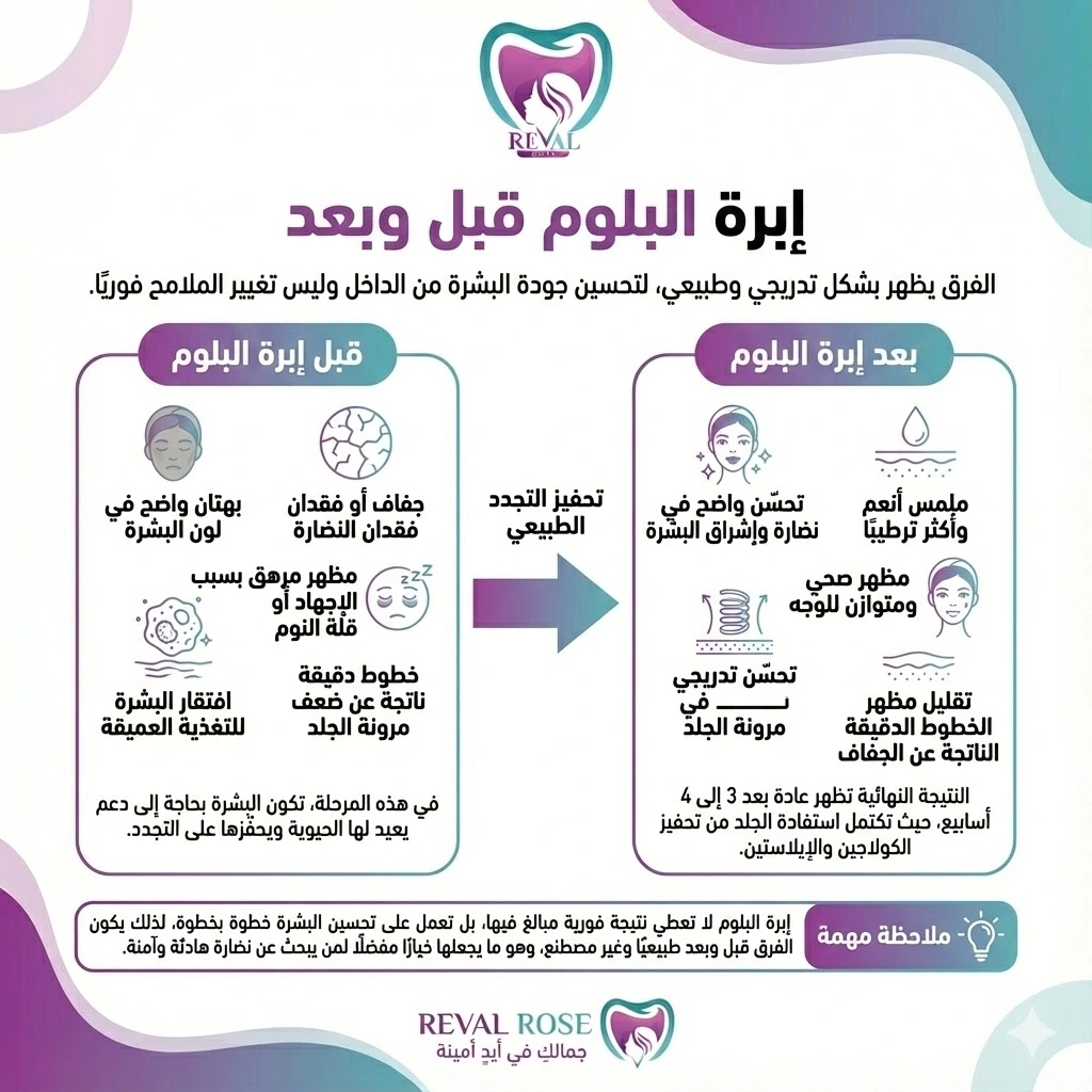 إبرة البلوم قبل وبعد