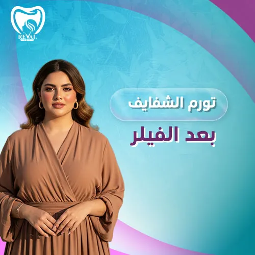 تجربتي مع فيلر الشفايف