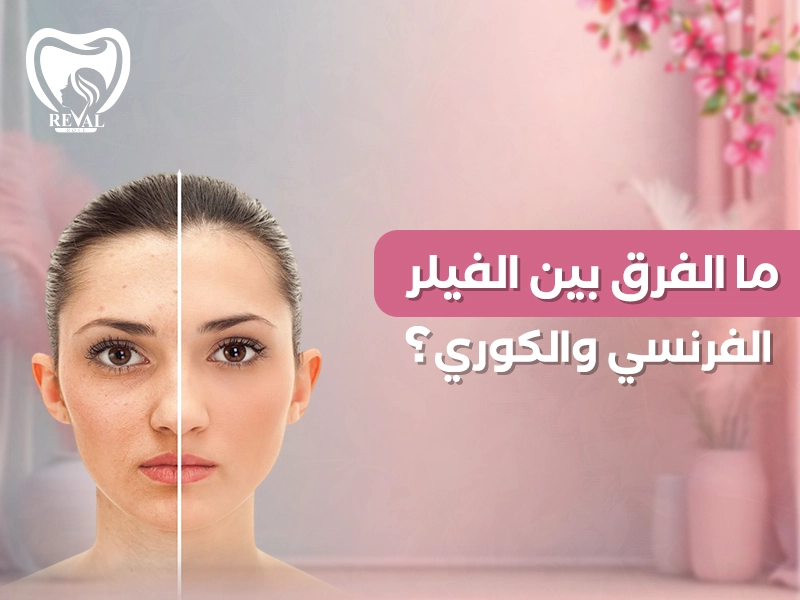 ما الفرق بين الفيلر الفرنسي والكوري؟دليل شامل لاختيار أفضل فيلر للوجه والشفاه بمظهر طبيعي