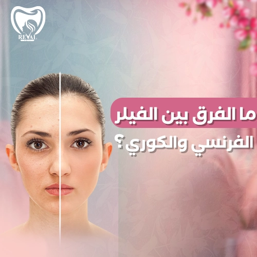 ما الفرق بين الفيلر الفرنسي والكوري