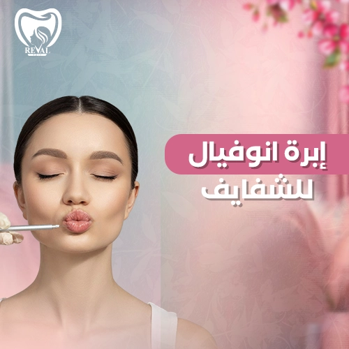 تجربتي مع إبرة انوفيال للشفايف