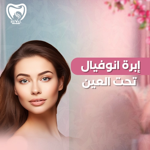 تجربتي مع إبرة انوفيال تحت العين