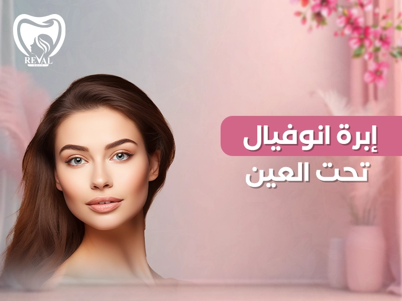 إبرة انوفيال تحت العين: الدليل الشامل لعلاج الهالات السوداء واستعادة نضارة العينين