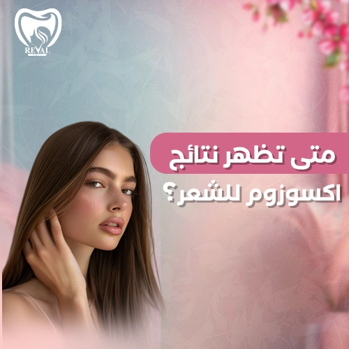 تجربتي مع الإكسوزوم للشعر