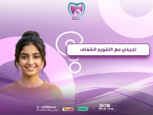 تجربتي مع التقويم الشفاف — تعليمات قبل وبعد تركيب تقويم الاسنان
