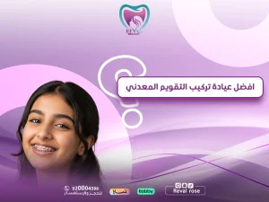 أفضل عيادة تركيب التقويم المعدني — كيف تختار أفضل دكتور تركيب تقويم معدني
