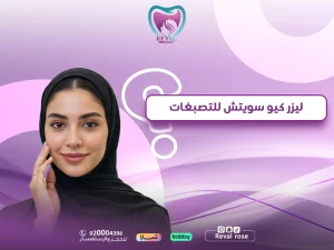 ليزر كيو سويتش للتصبغات: الحل الذكي لتجديد جمال البشرة بثقة