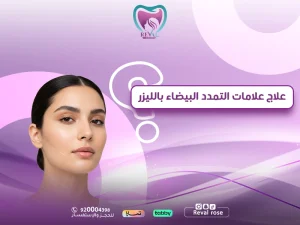 علاج علامات التمدد البيضاء بالليزر: الحل الحديث لتجديد الجلد واستعادة الثقة في المظهر