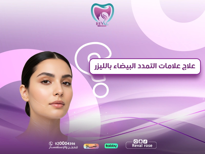 علاج علامات التمدد البيضاء بالليزر