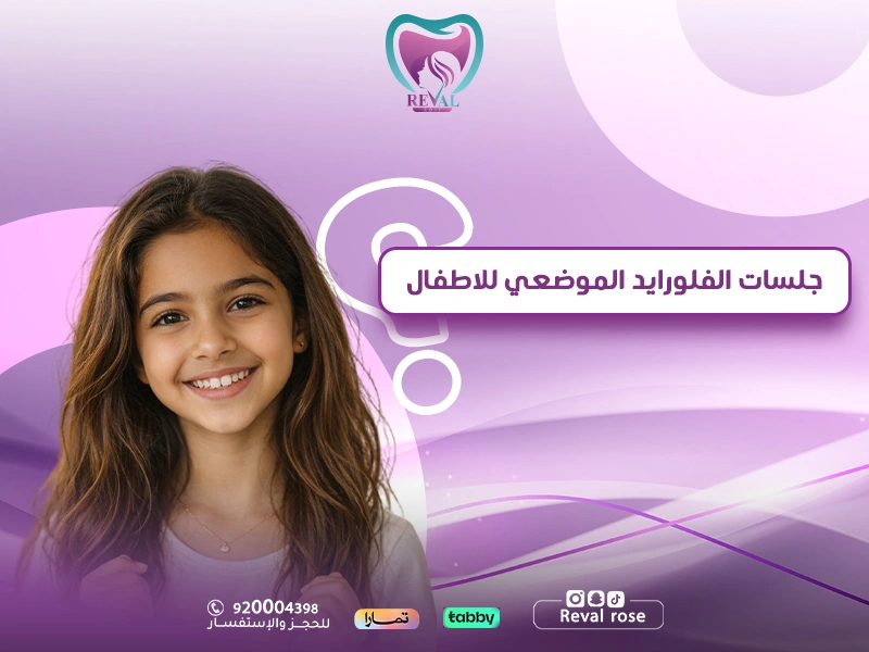 جلسات الفلورايد الموضعي للأطفال