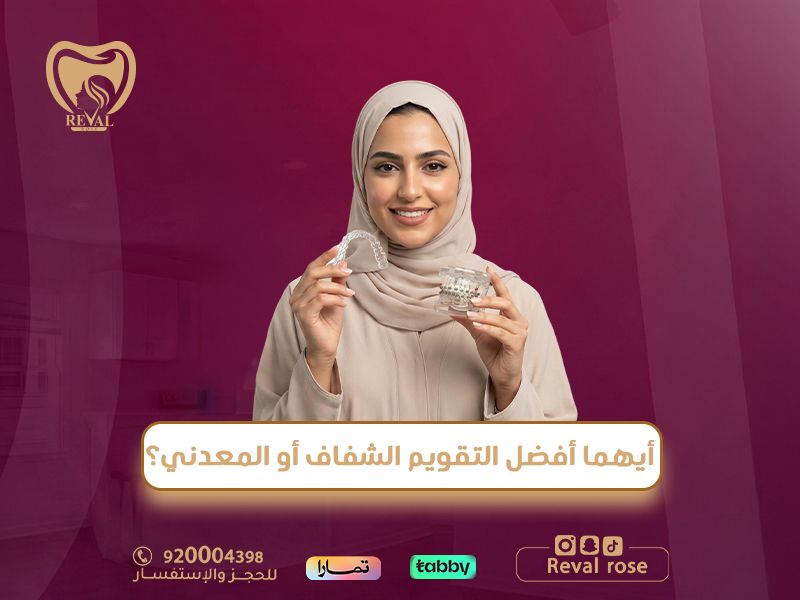 أيهما أفضل التقويم الشفاف أو المعدني؟ دليلك الكامل قبل أن تقرر