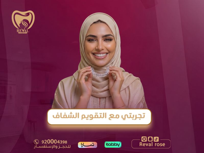 كيف أعتني بالتقويم الشفاف؟ تجربتي مع التقويم الشفاف