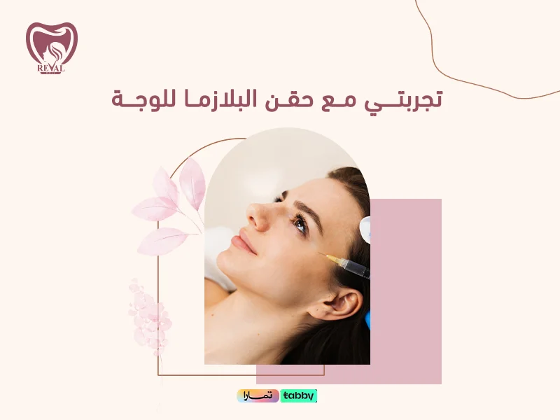 تجربتي مع حقن البلازما للوجه: كل ما تحتاجين معرفته قبل التجربة