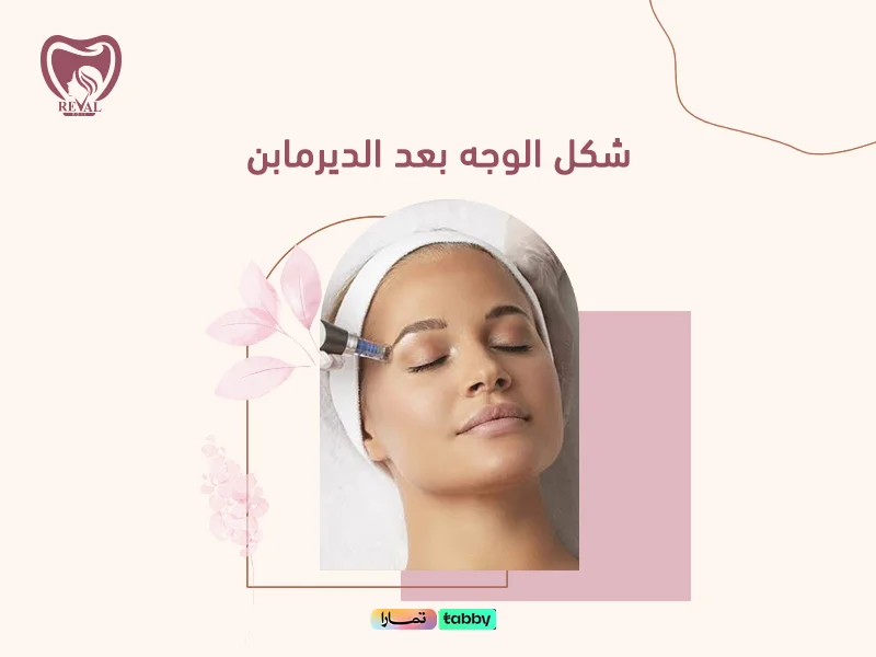 شكل الوجه بعد الديرمابن: ماذا يحدث للبشرة ومتى تظهر نتائج جلسات الديرما⁉️