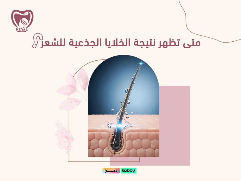 متى تظهر نتيجة الخلايا الجذعية للشعر؟ رحلة استعادة كثافة شعرك خطوة بخطوة