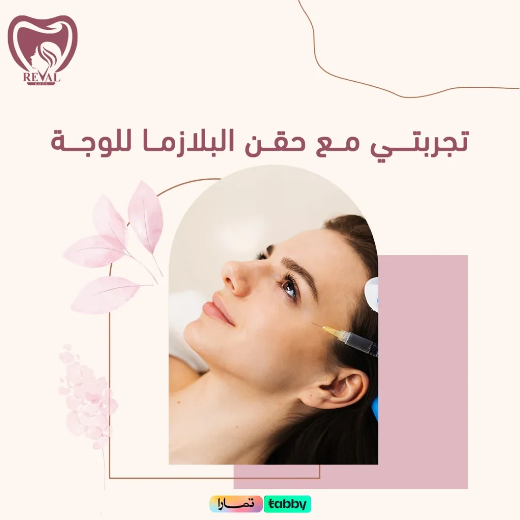 تجربتي مع حقن البلازما للوجه