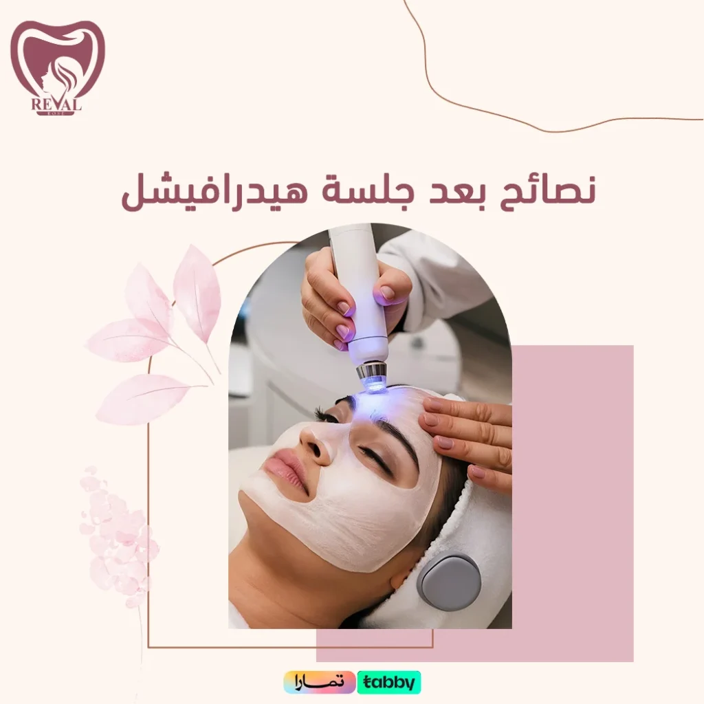 كم تدوم نتائج هيدرافيشل